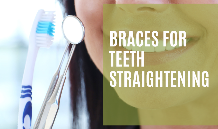 Braces For Teeth Straightening