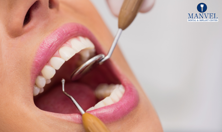 Implant Dentistry in Manvel