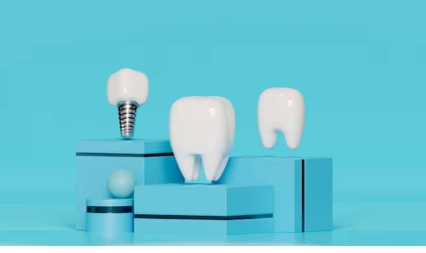 Dental Implants in Manvel, TX, Manvel Dental & Implant Center