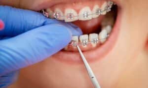 Oral Hygiene in Manvel, TX, Manvel Dental & Implant Center